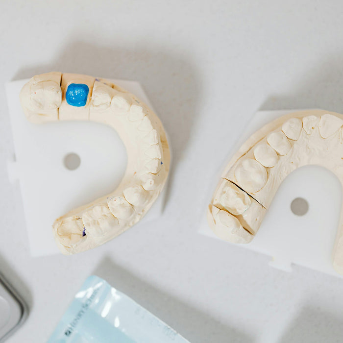 Digital Dentistry vs. Traditional Molds: Which Impression Method Is Right for You?