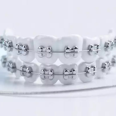 Choosing the Best Orthodontic Supplies for Superior Patient Care