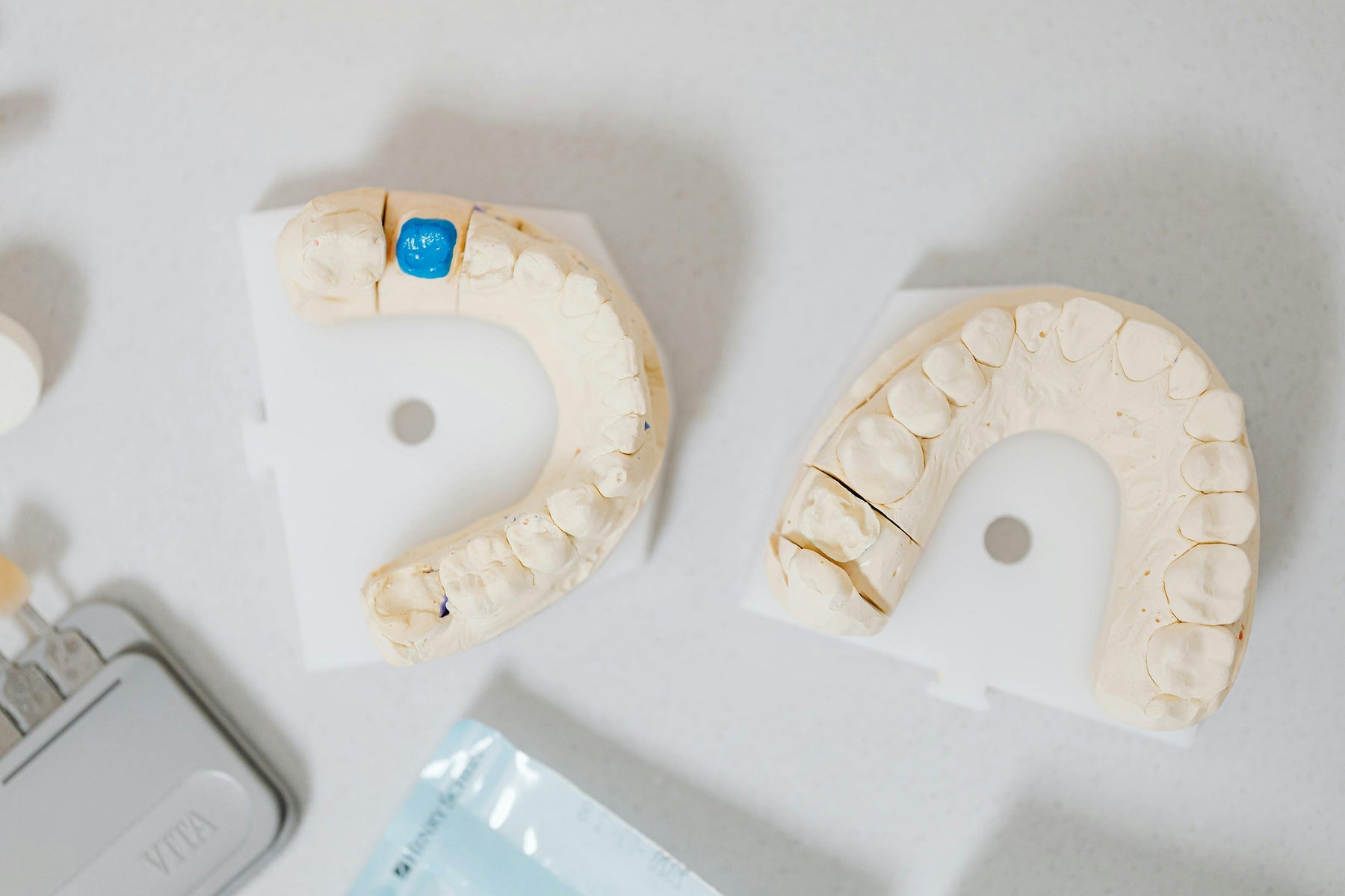 Digital Dentistry vs. Traditional Molds: Which Impression Method Is Right for You?