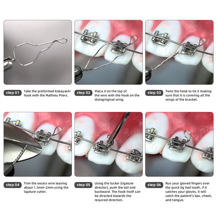 JMU Dental Kobayashi Ligature Wire Long 100/pk - JMU DENTAL INC