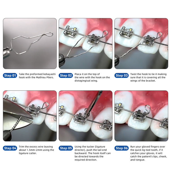 JMU Dental Kobayashi Ligature Wire Short 100/pk - JMU DENTAL INC
