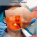JMU Dental Handheld Light Protection Shield - JMU DENTAL INC