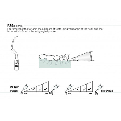 Woodpecker P20 Ultrasonic Scaler Tips 5pcs/Set- jmudental.com