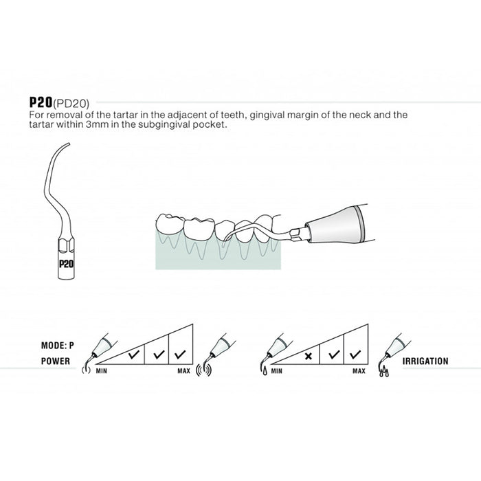 Woodpecker P20 Ultrasonic Scaler Tips 5pcs/Set- jmudental.com