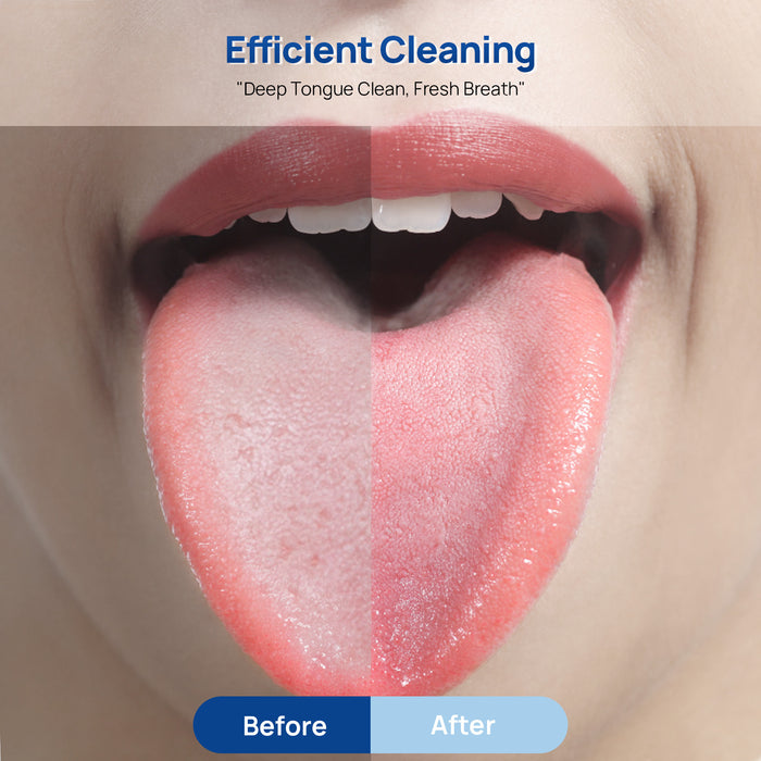 JMU 304 Stainless Steel Tongue Cleaner with Travel Case 2Pcs/Pack - JMU DENTAL INC