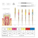 JMU NITI ROTARY FILES, PT-G SUPER FILES #D-SUPER FILES (GOLD) - JMU Dental