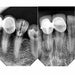 iRay Dental Digital Intra-oral Sensors Black - JMU DENTAL INC