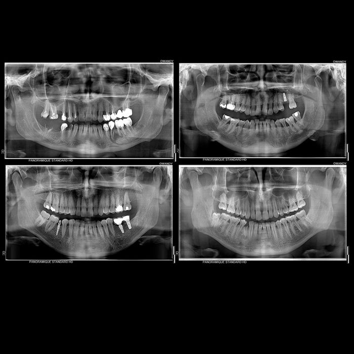 Owandy I-Max PRO Wall-Mounted Digital Pan Unit Dental Panoramic System