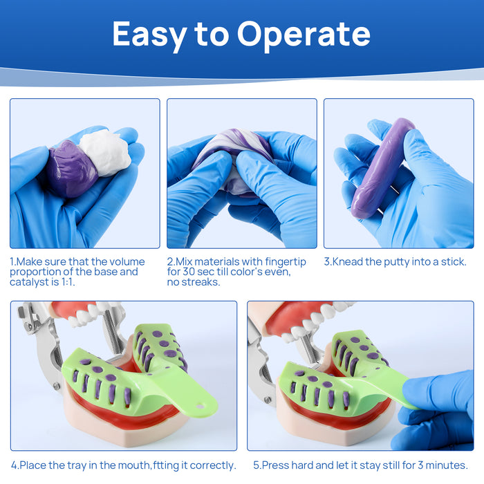 JMU Dental Impression Materials Putty - Normal/ Fast Set - JMU DENTAL INC