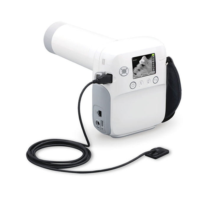 Genoray ZEN-PX4 Portable X-ray Source for Flexible Digital Radiography