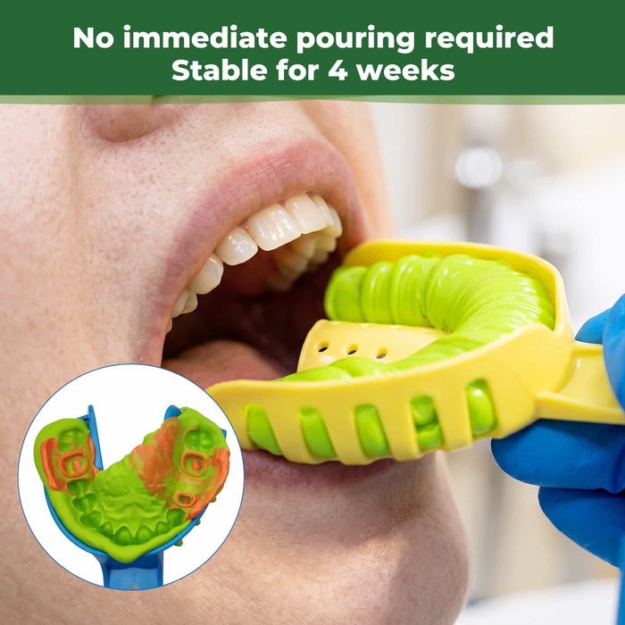Impression Material Stable for 4 Weeks with No Immediate Pouring Required - JMU DENTAL INC