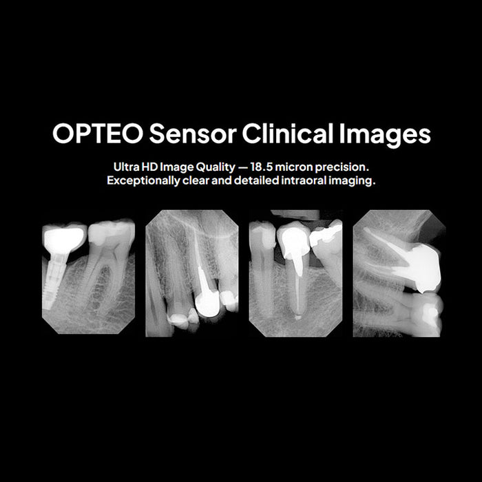 Owandy OPTEO Digital Intraoral Sensor Three Sizes for High-Resolution Dental Radiography