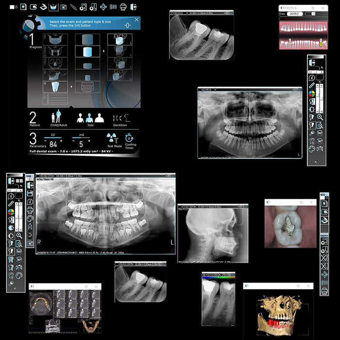 Owandy OPTEO Digital Intraoral Sensor Three Sizes for High-Resolution Dental Radiography