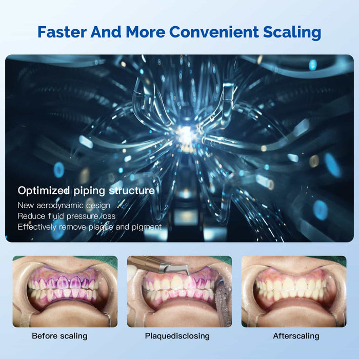 Woodpecker AP-A Dental Air Polisher Supra/Subgingival Scaling - JMU DENTAL INC