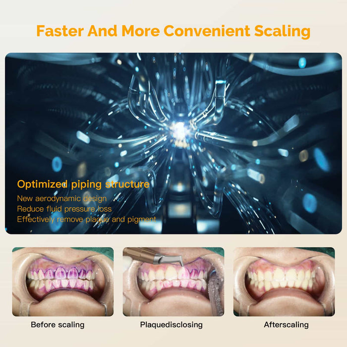 Woodpecker AP-B Dental Air Polisher & Ultrasonic Scaler Prophylaxis Unit 2 In 1 - JMU DENTAL INC
