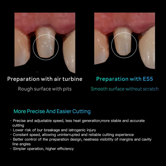 Woodpecker Dental Electric Surgical Motor ES5 with Handpieces - JMU DENTAL INC