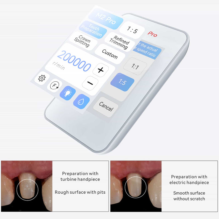 Woodpecker Dental Brushless Electric Motor M2 Pro w/ 1:5 Contra Angle Handpiece - JMU DENTAL INC