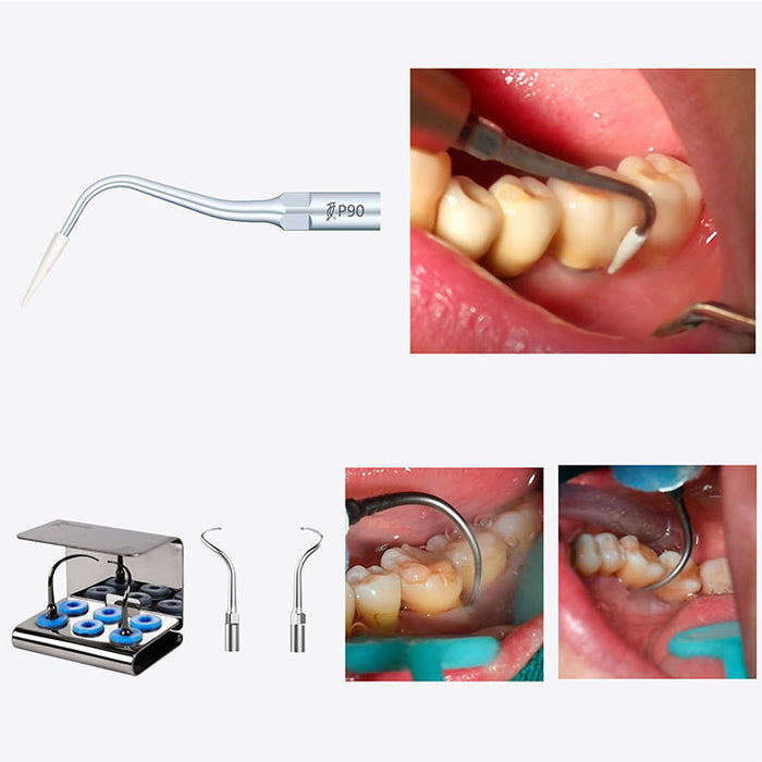 woodpecker-periodontal-treatment-device-pt3-painless-supragingival-and-subgingival-scaling