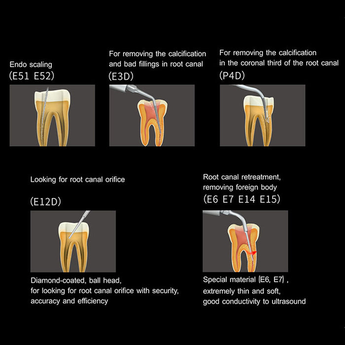 woodpecker-periodontal-treatment-device-pt5-root-canal-treatment-jmu-dental-supply