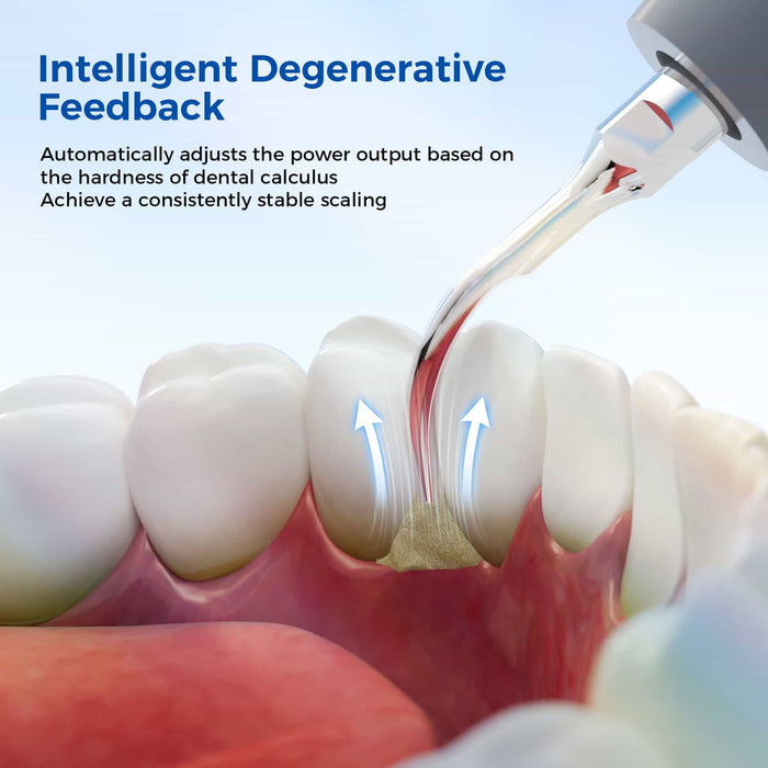 Woodpecker ultrasonic scaler intelligent degenerative feedback technology automatically adjusting power output based on calculus hardness for stable scaling - JMU DENTAL INC
